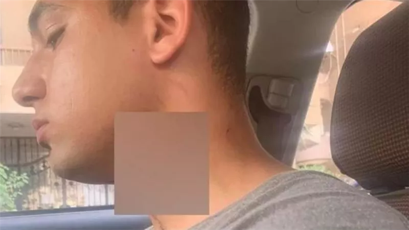  أب اعتدى على نجله بـ سكين في مدينة نصر..وجهات التحقيق تأمر بحبسه