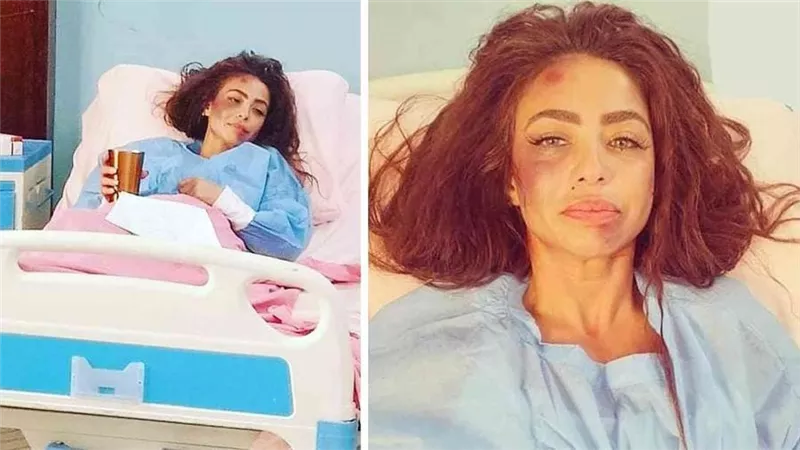 تحرك قانوني ضد دوللي شاهين بعد ادعاء تعرضها للضرب من مجهولين