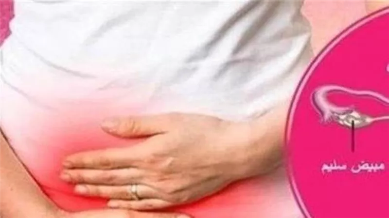 تكيس المبايض لدى النساء، مخاطر قد تنتقل للأبناء الذكور