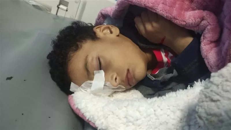 فقد عينه بسبب مدرسة.. تحقيق عاجل في إصابة تلميذ داخل مدرسة بنجع حمادي