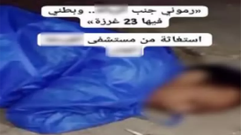 حقيقة فيديو طرد مريض مصاب بالإيدز من مستشفى بالغردقة.. شقيقه يكشف التفاصيل