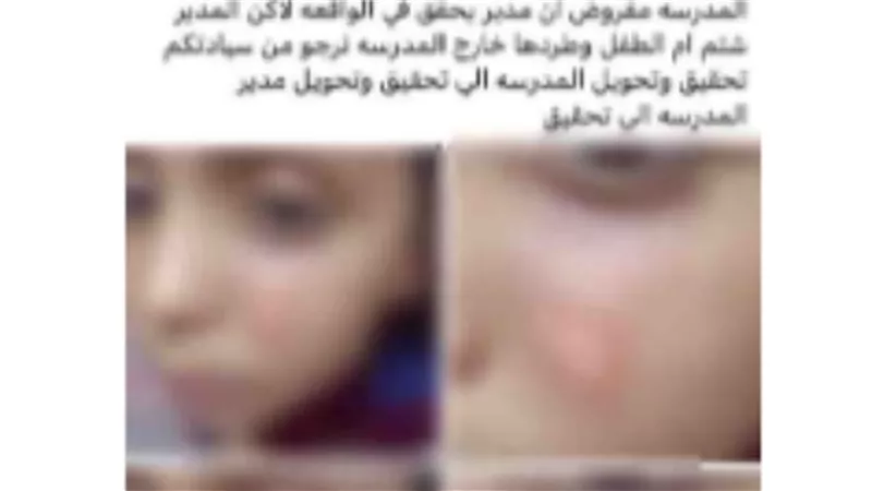 مدير المدرسة طرد أهله.. القبض على مدرسة حرقت وجه طالب بسوهاج 